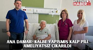 Ana Damar- Kalbe Yapışmış Kalp Pili Ameliyatsız Çıkarıldı